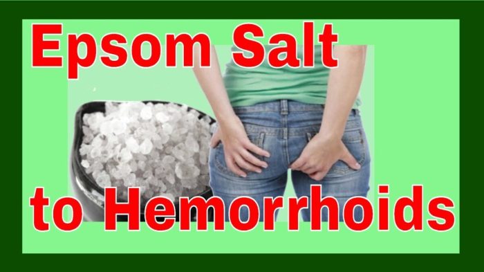 Hemorrhoids ointment molooco